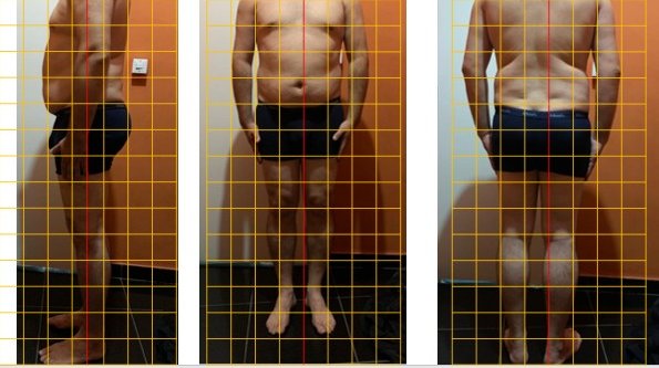 Avaliação postural com grade de referência — vista frontal, lateral e posterior