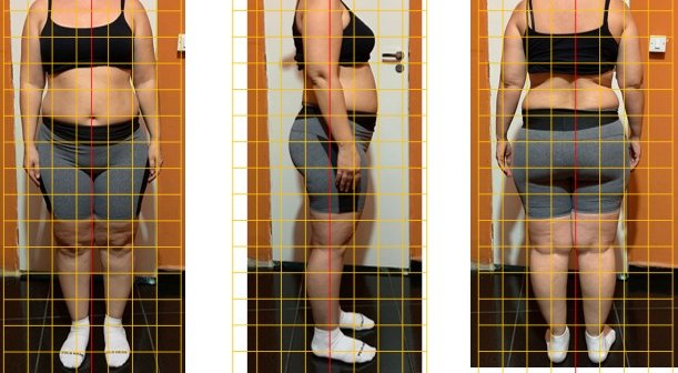 Avaliação postural com grade de referência — vista frontal, lateral e posterior