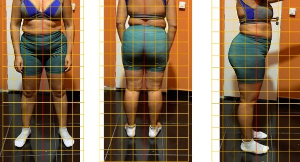 Avaliação postural com grade de referência — vista frontal, lateral e posterior