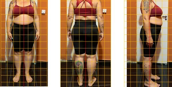 Avaliação postural com grade de referência — vista frontal, lateral e posterior